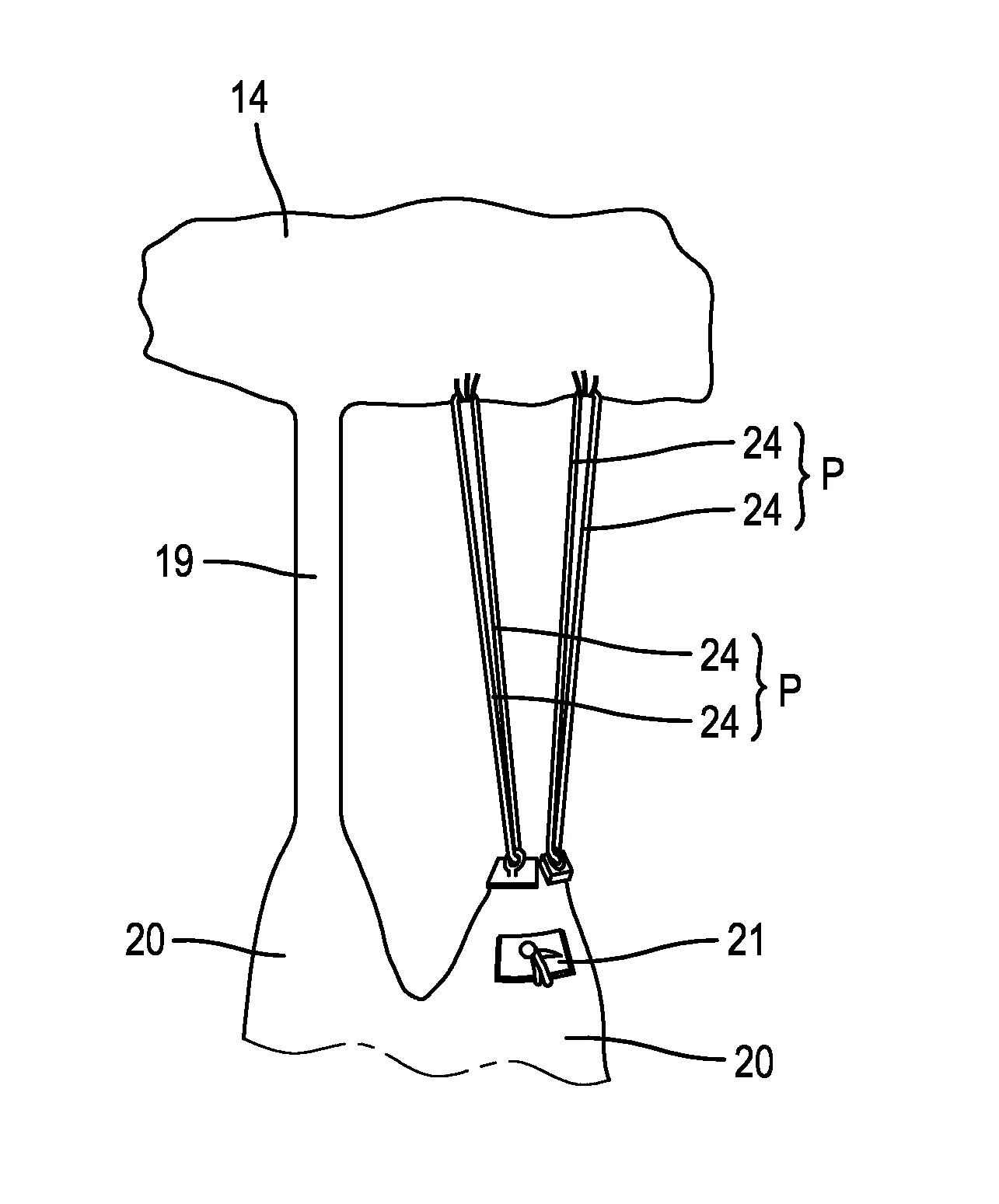 Dispositif de remplacement d'au moins un cordage de la valve mitrale et kit comprenant au moins deux dispositifs