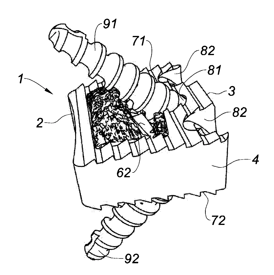 Cage de fusion intervertebrale