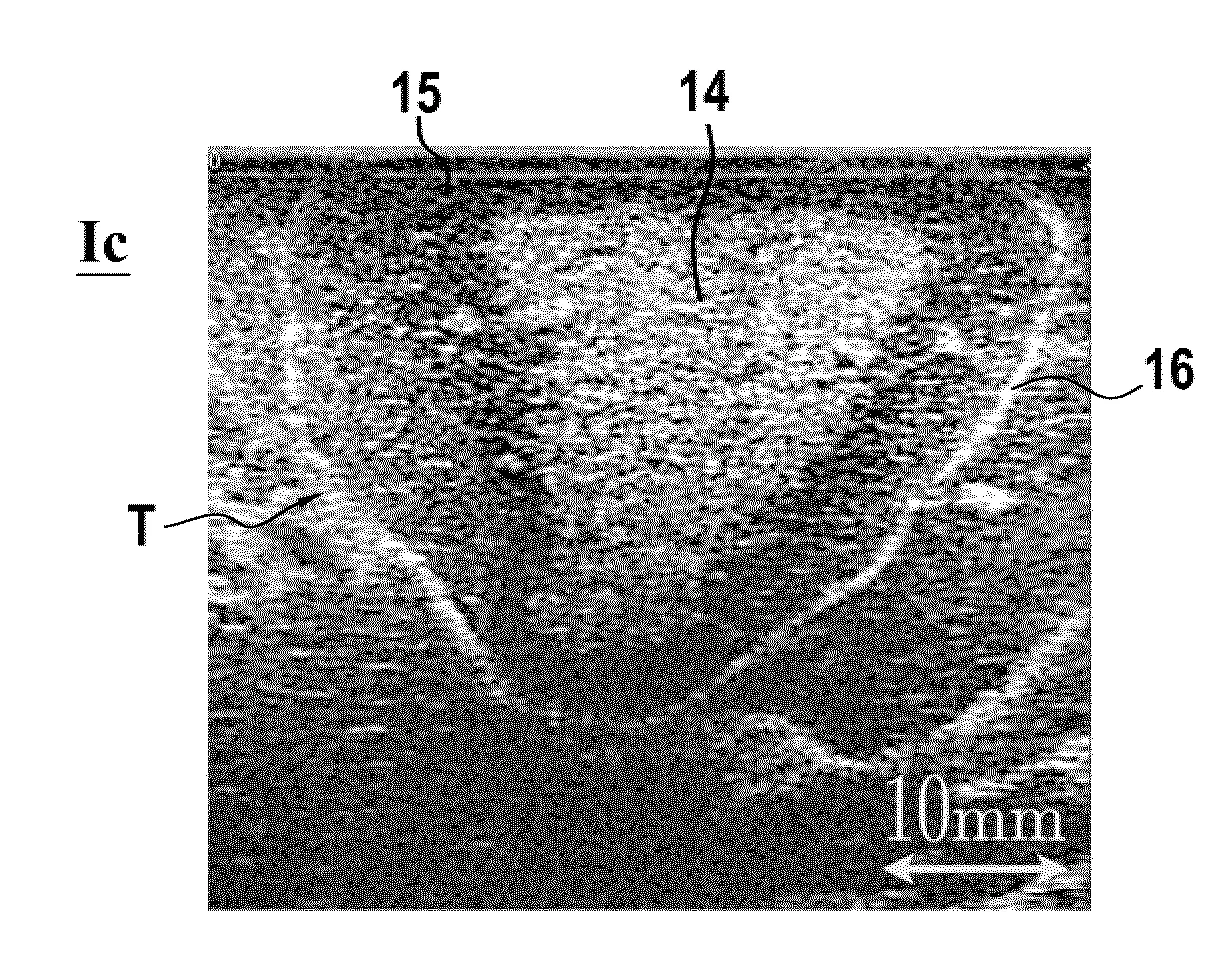 Procede de caracterisation d'une lesion ultrasonore de tissus organiques