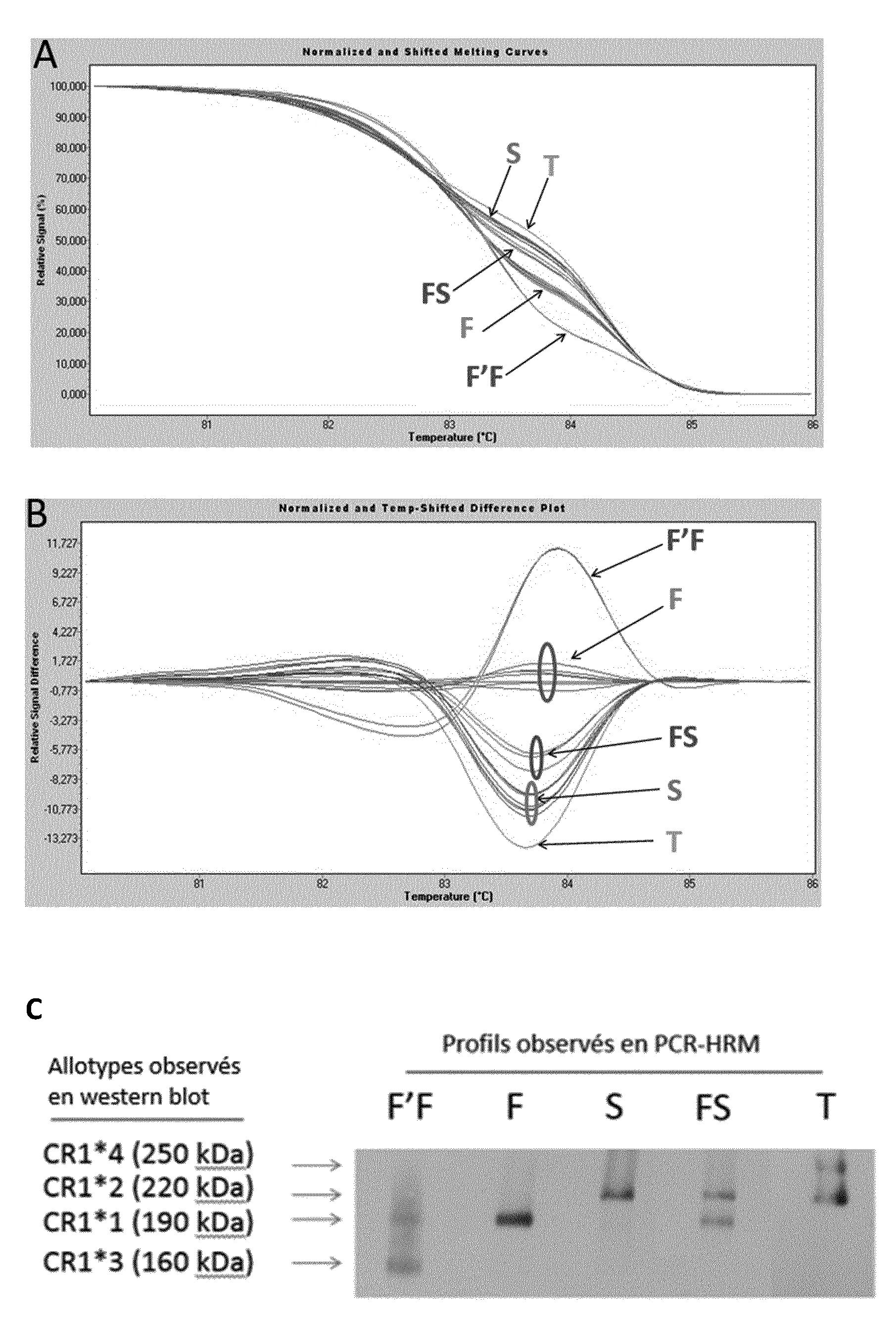 Methode de determination du polymorphisme de longueur du recepteur cr1.